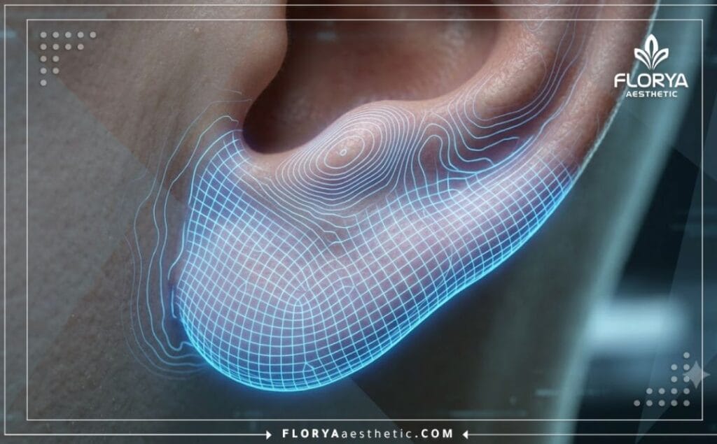 فحص رقمي ثلاثي الأبعاد لمنطقة شحمة الأذن يوضح دقة الجراحة التجميلية