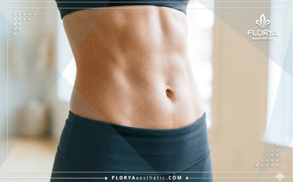 Flawless aesthetic result of a successful body sculpting procedure showing a toned waistline.