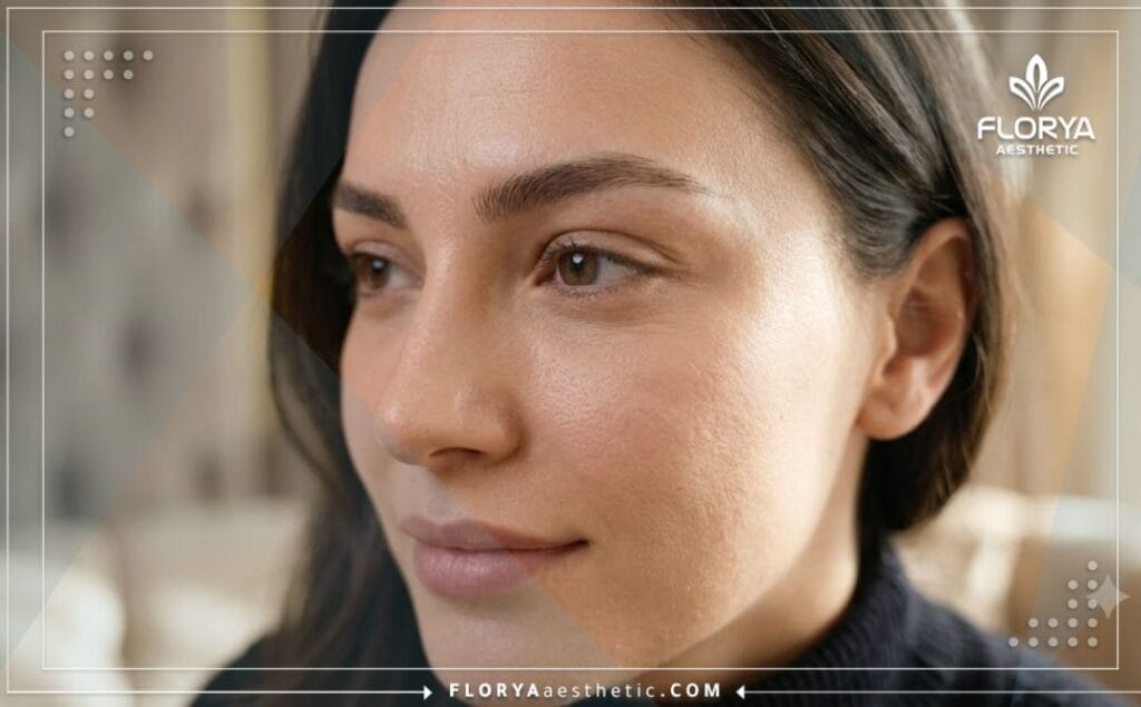 Close-up cinematic shot highlighting the flawless and natural lifted outcome of an aesthetic eye procedure.