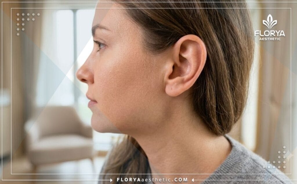 Résultat esthétique parfait et naturel après une intervention sur les oreilles.