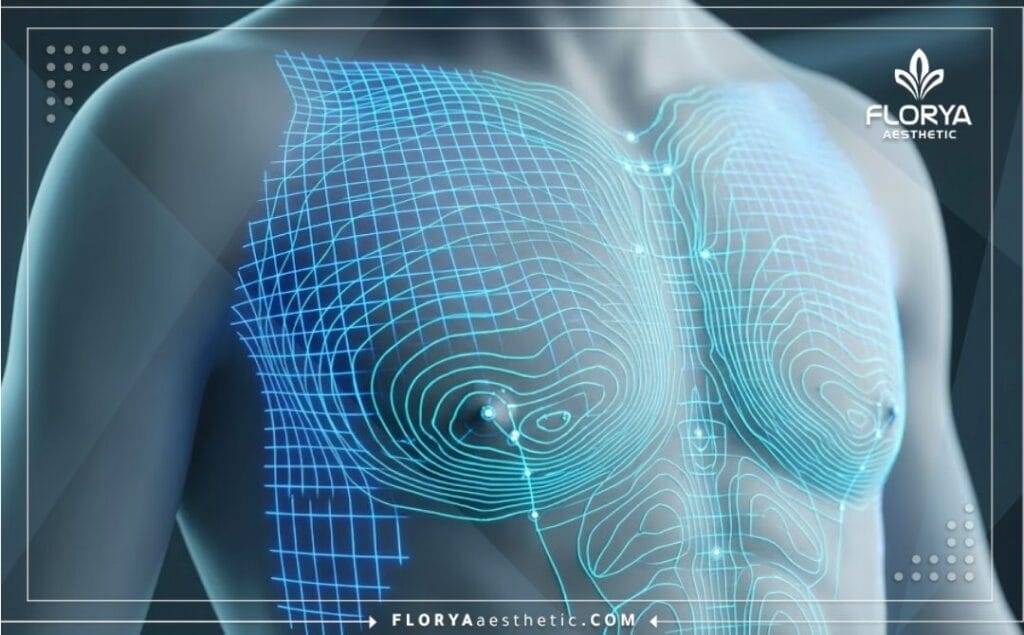 Advanced macro 3D surface scan featuring a precise neon blue laser grid over the chest area anatomy.
