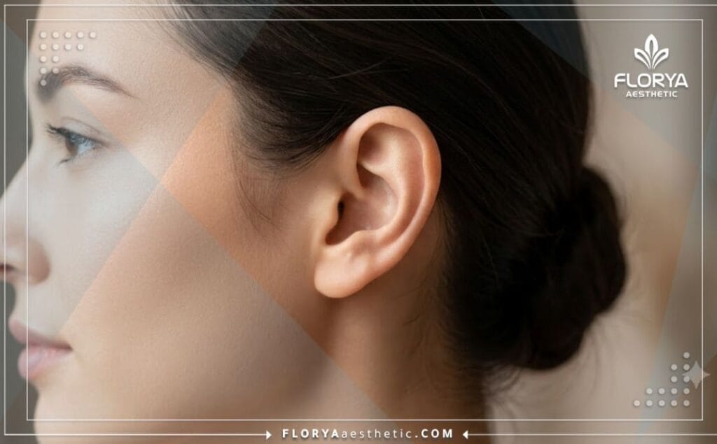 Flawless aesthetic outcome highlighting a beautifully contoured ear after successful otoplasty