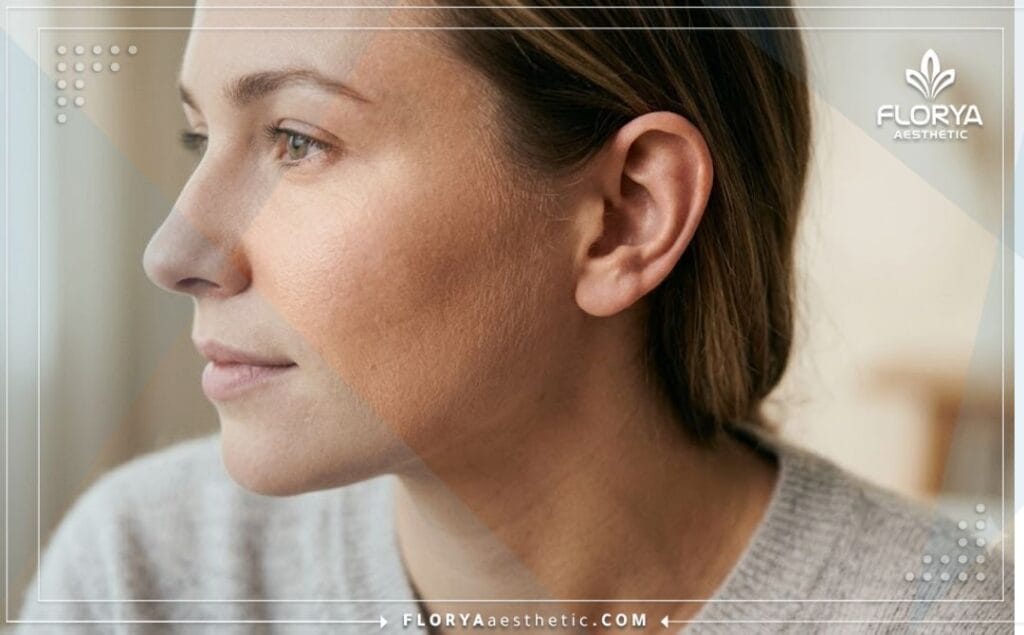 Close-up of flawless aesthetic results after prominent ear pinning surgery