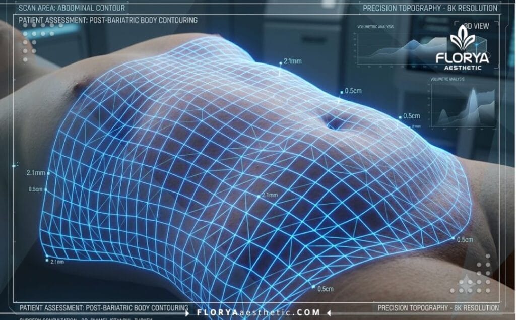 Futuristic macro 3D surface scan with a neon blue laser grid focusing on the body contouring anatomical area