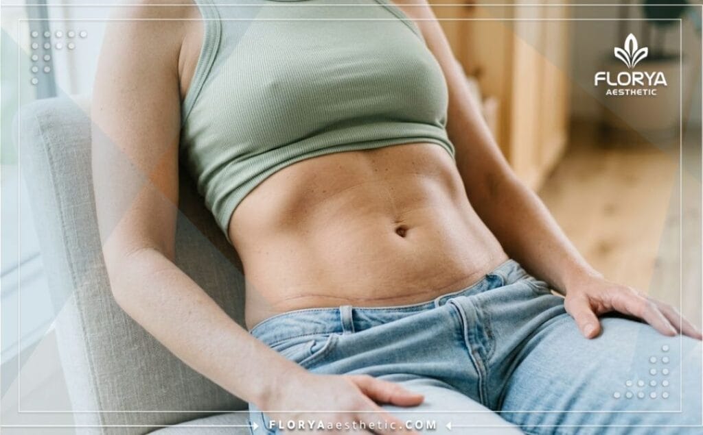 Cinematic shot of a flat and perfect post-surgery abdomen