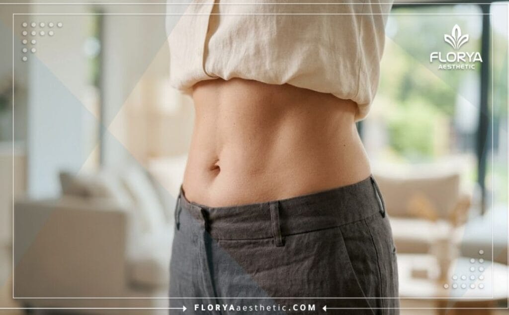 Perfect and natural successful result of a body lift procedure