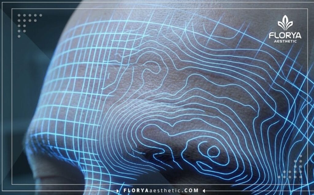 ماسح طبي ثلاثي الأبعاد وتحليل رقمي دقيق لمنطقة الجبهة وعلاج التجاعيد.