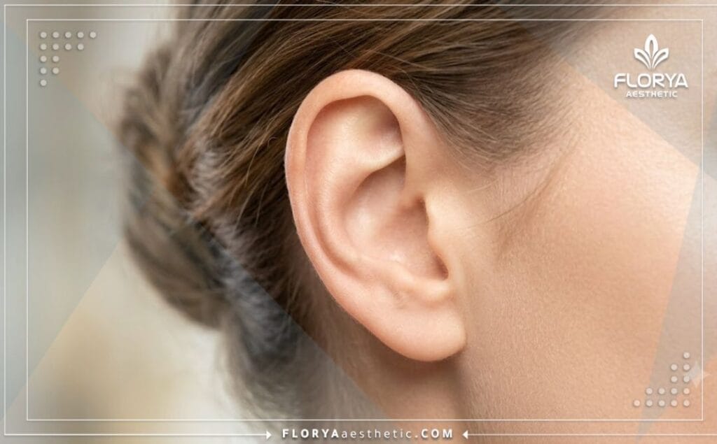 Gros plan sur le résultat esthétique parfait et naturel après la correction des oreilles.