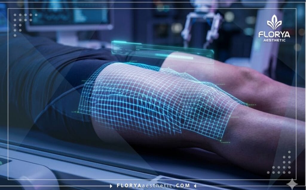 High-tech digital 3D macro scan of the thigh anatomy for precise sculpting