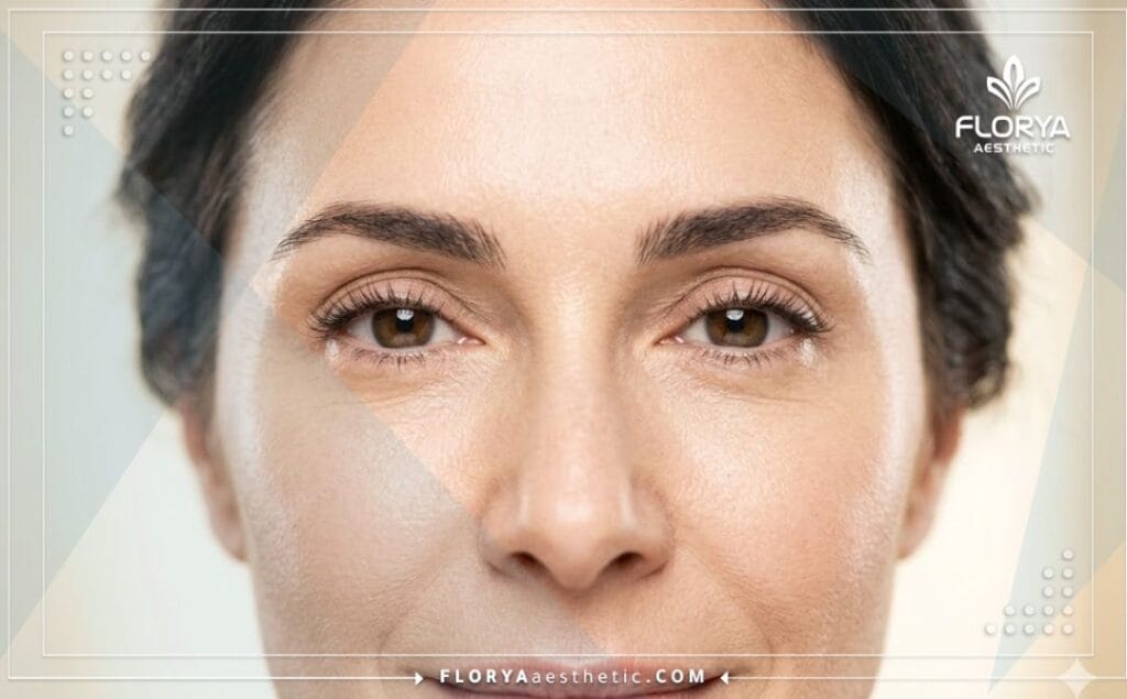 Cinematic close-up showing the perfect, natural aesthetic outcome of the eye area.