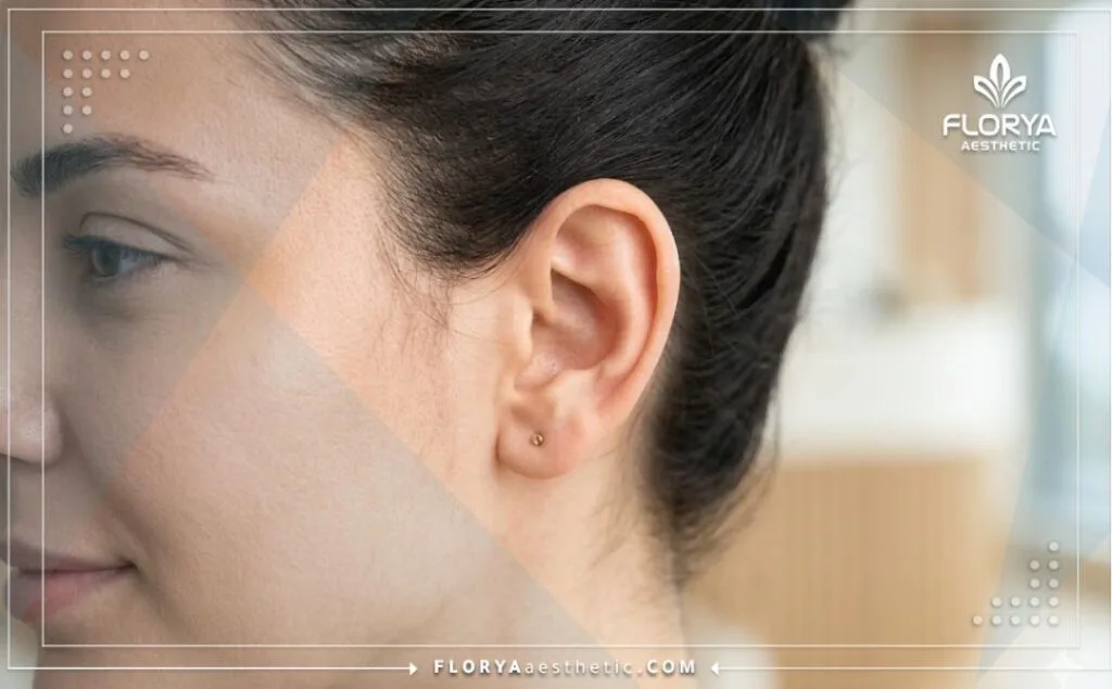 نتائج مثالية وطبيعية لعملية تجميل الأذن باستخدام أحدث التقنيات