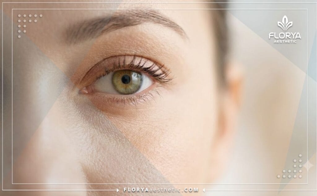 Primer plano que muestra el resultado estético impecable y natural en la zona de los ojos.