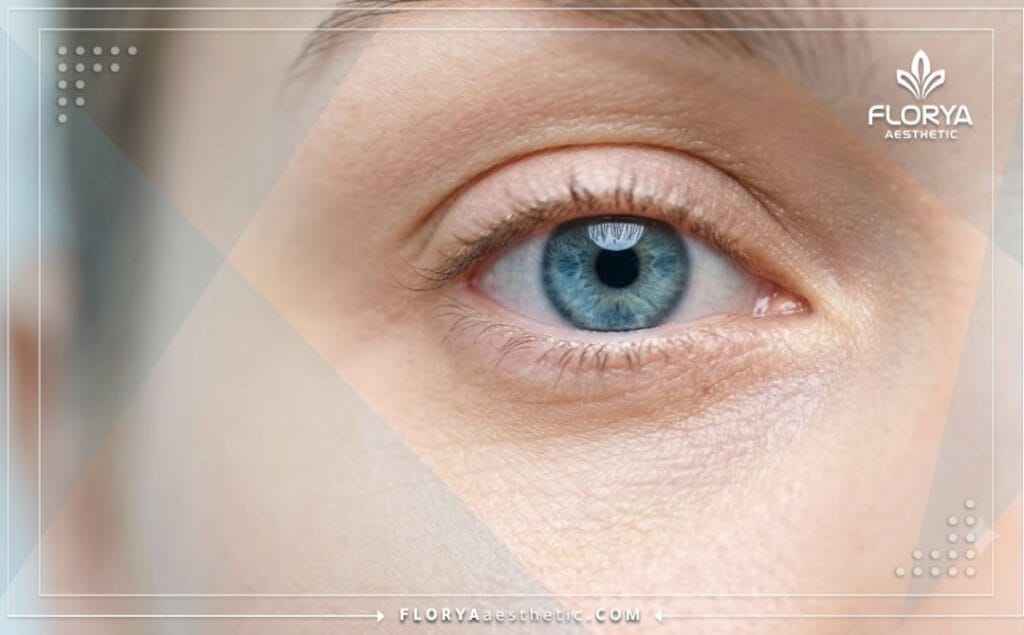 Flawless aesthetic outcome of delicate eyelid and facial cosmetic surgery