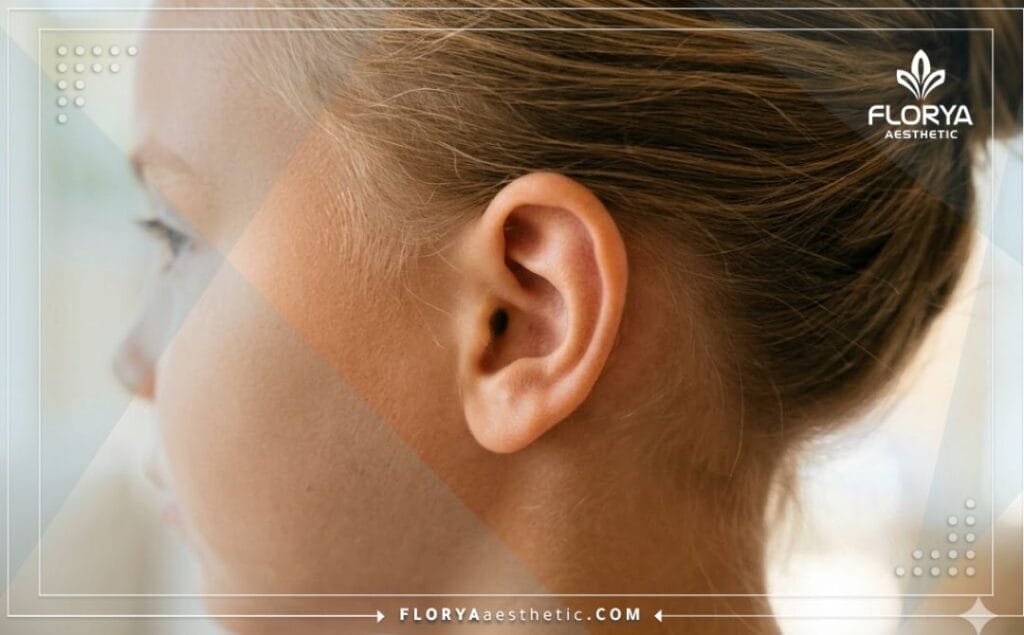 Flawless, natural aesthetic result of a successful ear surgery.