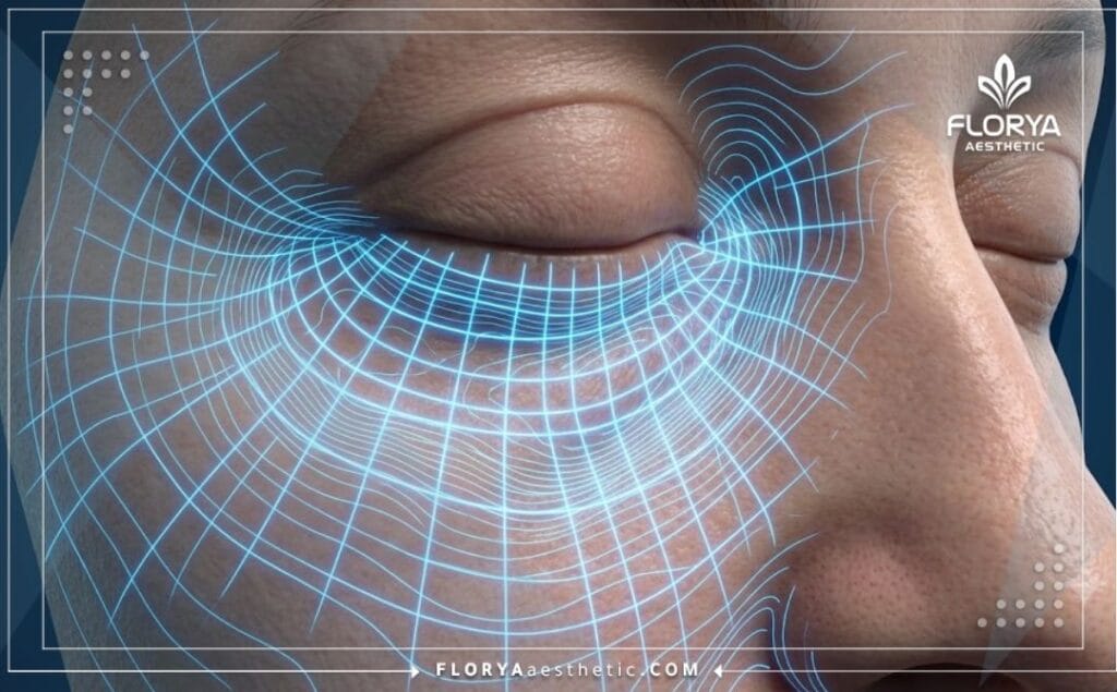 Scan 3D numérique détaillé de la zone orbitale pour un traitement précis