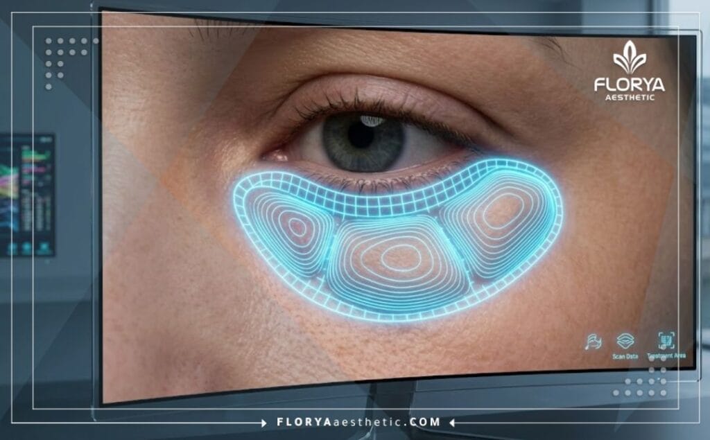 Scanner 3D haute technologie de la région sous-orbitaire montrant une précision médicale parfaite.