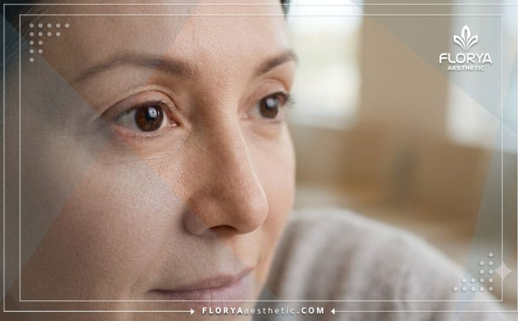 صورة سينمائية مقربة تظهر النتيجة المثالية والناجحة لعملية تجميل وشد الجفون