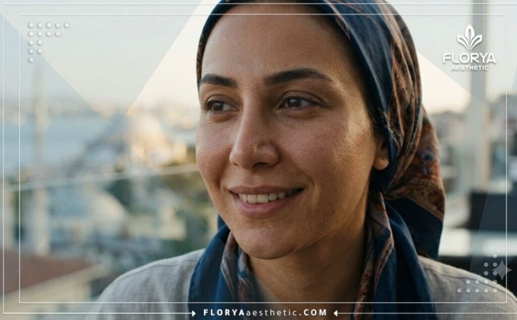 نتيجة مثالية وجمالية لعملية تجميل الأنف.