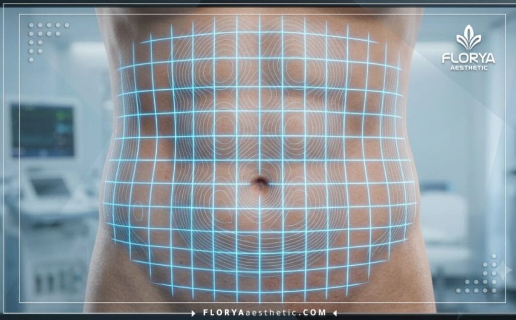 Escaneo digital en 3D de alta tecnología que muestra la cuadrícula topográfica del área abdominal de forma precisa.