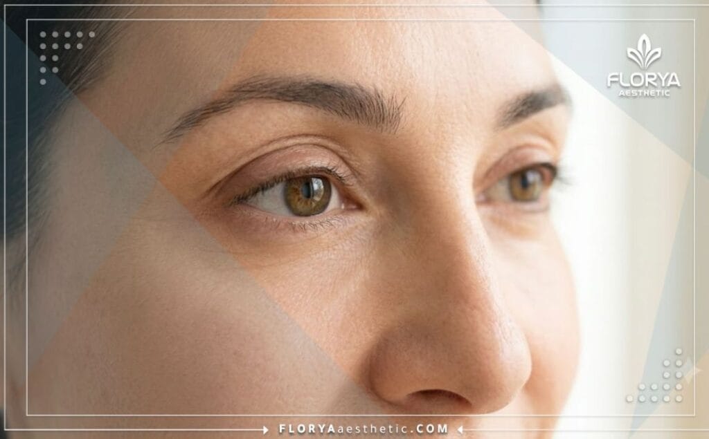 نتيجة مثالية وطبيعية لمنطقة العين بعد الإجراء التجميلي الناجح