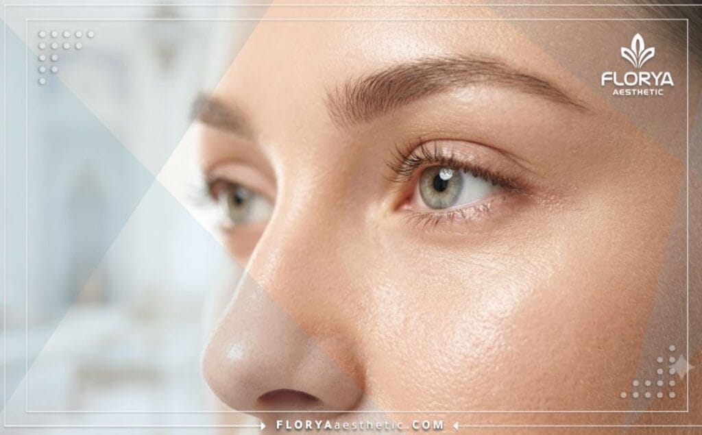 نتائج مثالية وجمالية طبيعية بعد الإجراء التجميلي للعين