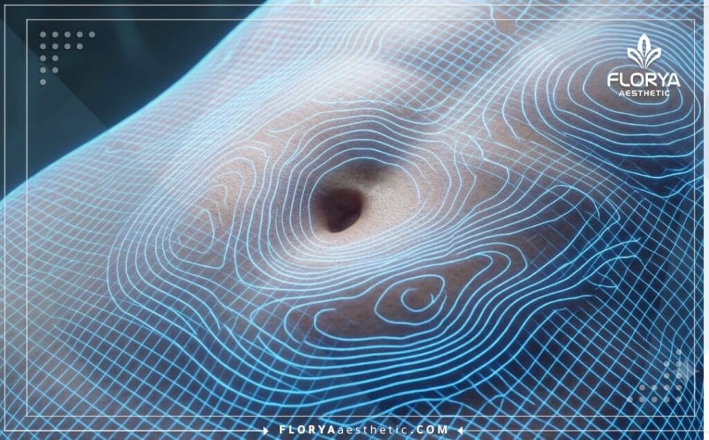 Escaneo digital 3D de alta precisión de la zona abdominal para la planificación de la cirugía estética.