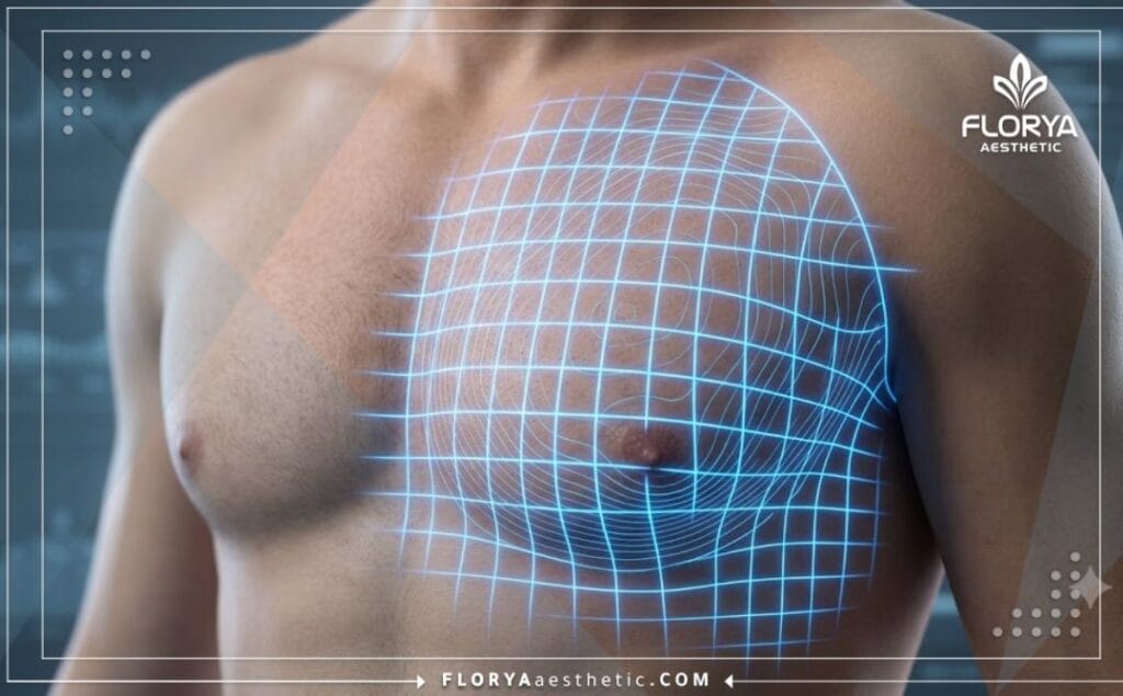 High-tech digital 3D mesh surface scan analyzing the male pectoral region for exact procedural mapping.