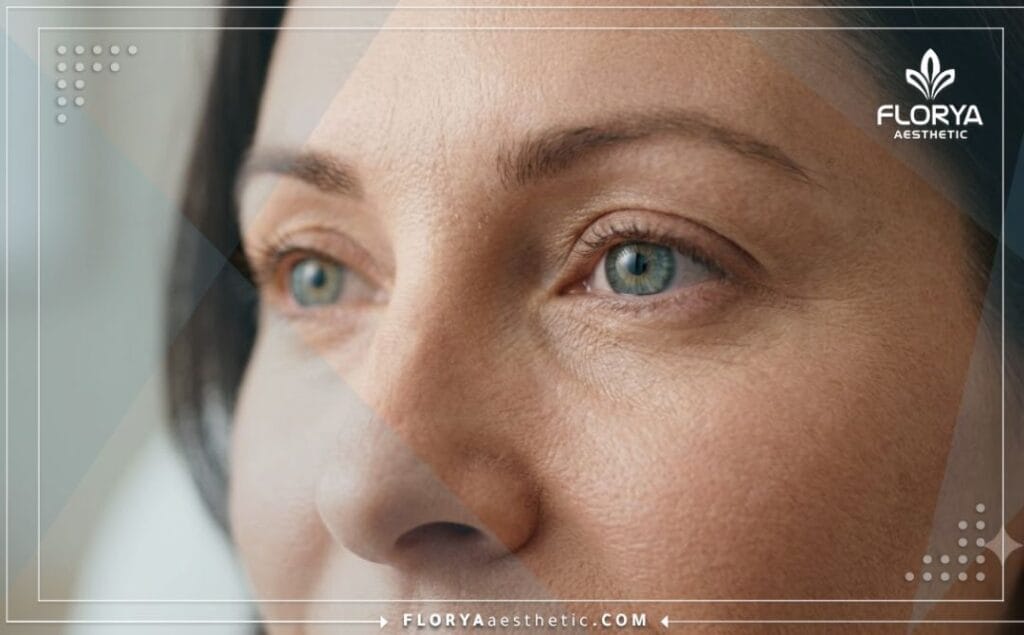 لقطة سينمائية مقربة تبرز النتائج الجمالية والمثالية لعملية تجميل منطقة العين.