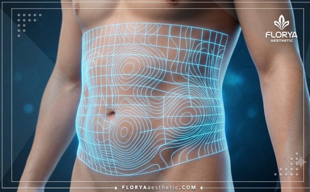 Macro digital 3D surface scan of the targeted body area for liposuction