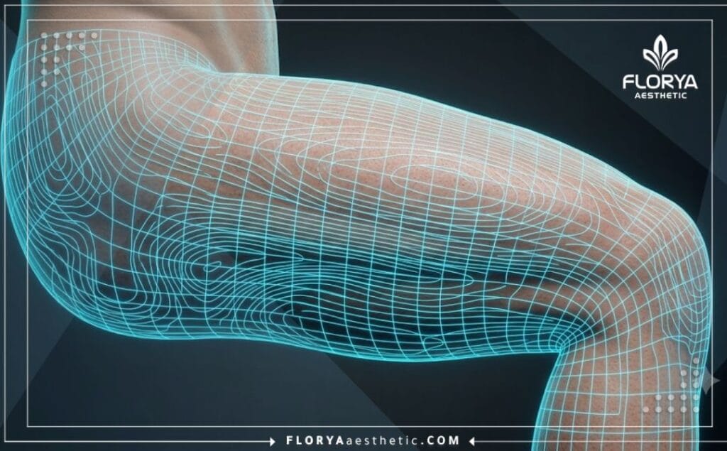 Высокотехнологичное 3D-сканирование анатомии бедра для точной коррекции