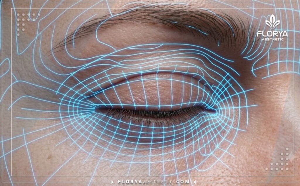 مسح رقمي ثلاثي الأبعاد لمنطقة العين يوضح دقة التخطيط التجميلي.