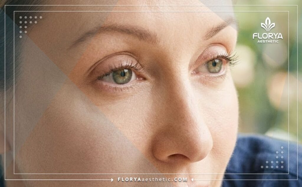 Close-up of flawless, rejuvenated eyelids showing the perfect aesthetic outcome.