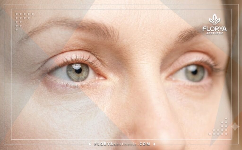 Flawless aesthetic outcome highlighting the natural beauty of successful eyelid surgery.