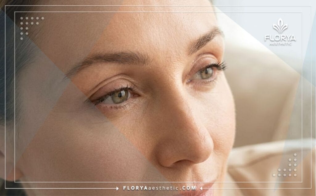 Un regard parfait et naturel suite à une Blépharoplastie et Lifting des Sourcils en Turquie.