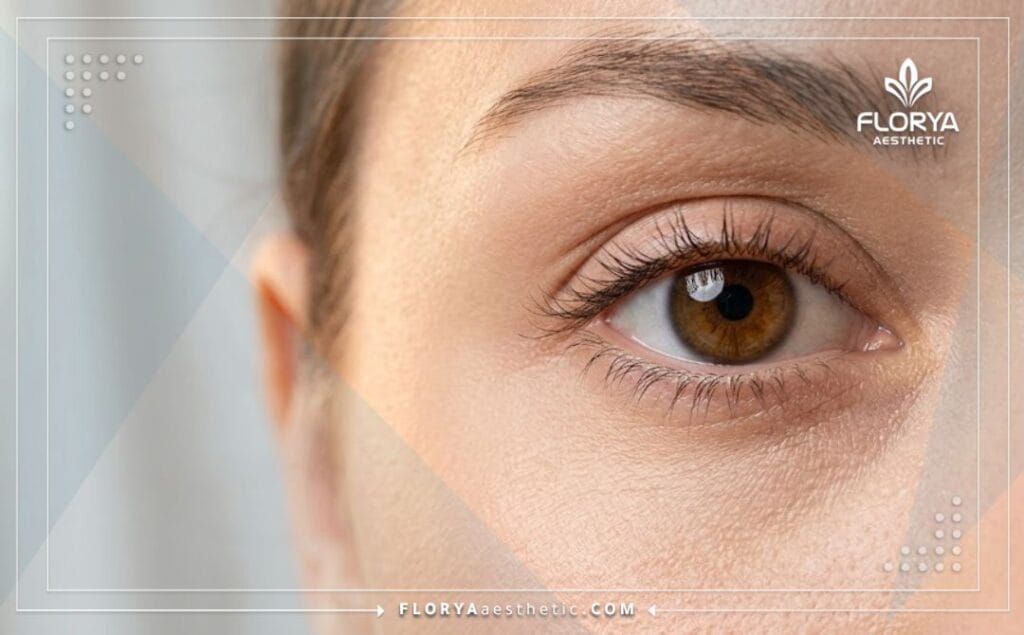 نتائج مثالية وطبيعية بعد إجراء عملية تجميل العيون بنجاح.