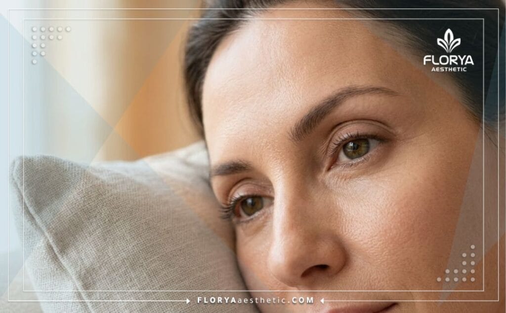 نتيجة مثالية وعيون شابة بعد عملية تجميل الجفون الناجحة.