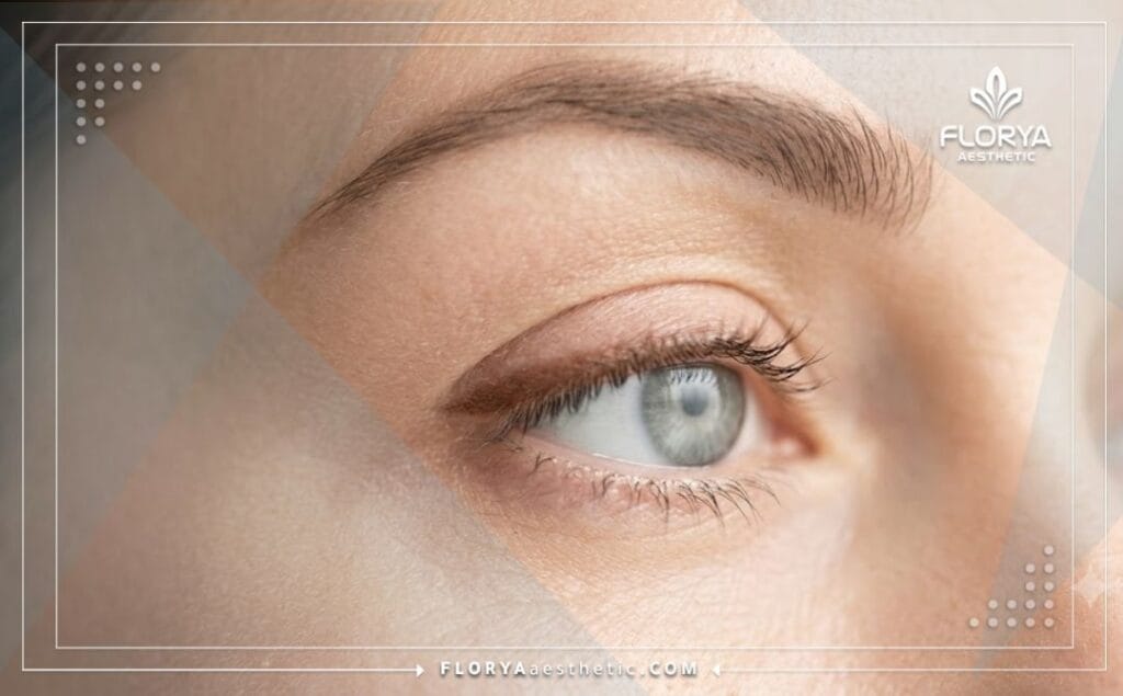 Flawless aesthetic outcome of successful Hooded Eyelid Surgery