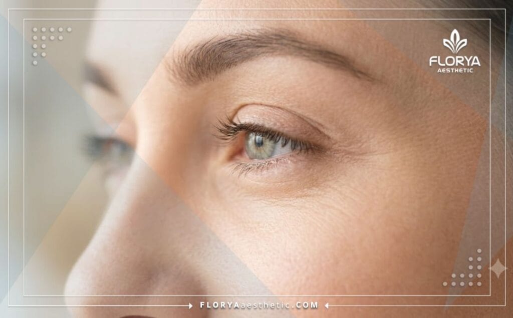 Cinematic close-up showing the flawless results of an eye shaping procedure.