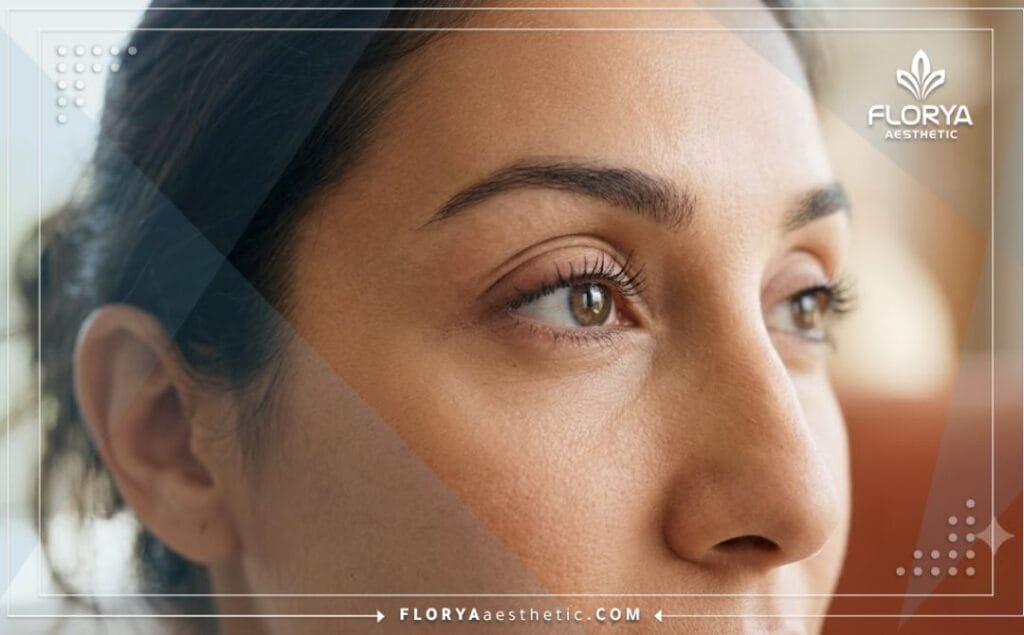 نتيجة مثالية وطبيعية لعملية تجميل الجفون تظهر العيون بمظهر شاب ومشرق