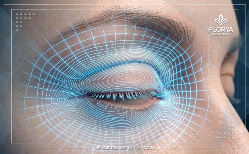 High-tech 3D macro surface scan focusing strictly on the upper eyelid anatomy and skin texture.