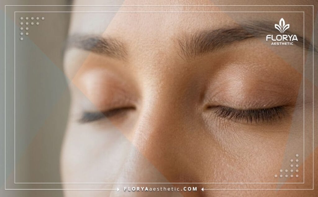 Close-up of a perfect aesthetic result showing Upper Blepharoplasty Benefits.