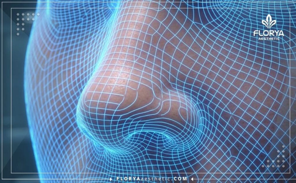 3D digital topographic laser mesh scanning the nasal anatomical region for precision planning