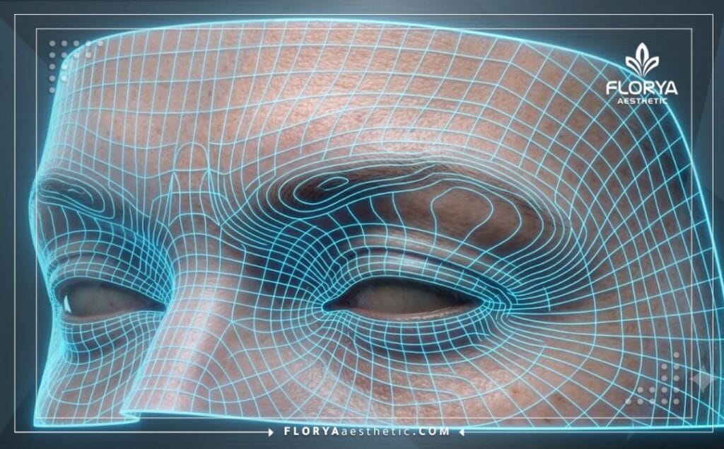 Escaneo digital 3D de alta tecnología de la zona ocular para un Lifting de Cejas y Párpados con Botox.