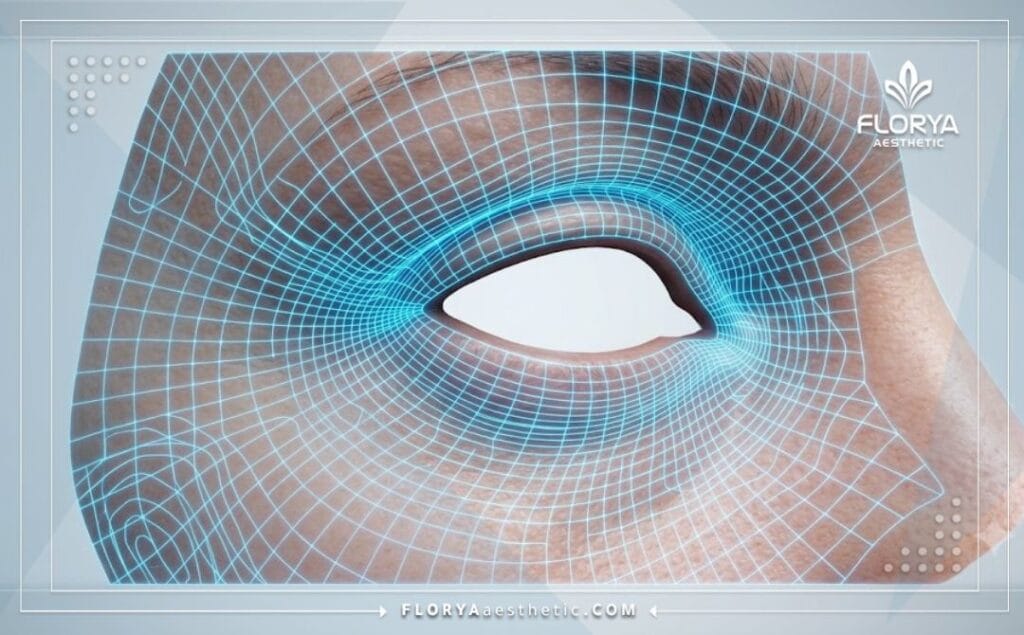 Escaneo 3D detallado de la zona de los ojos y párpados