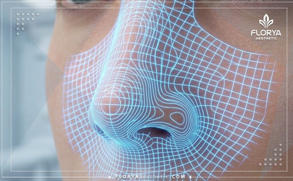 High-tech 3D macro surface scan of the nasal region for surgical precision.