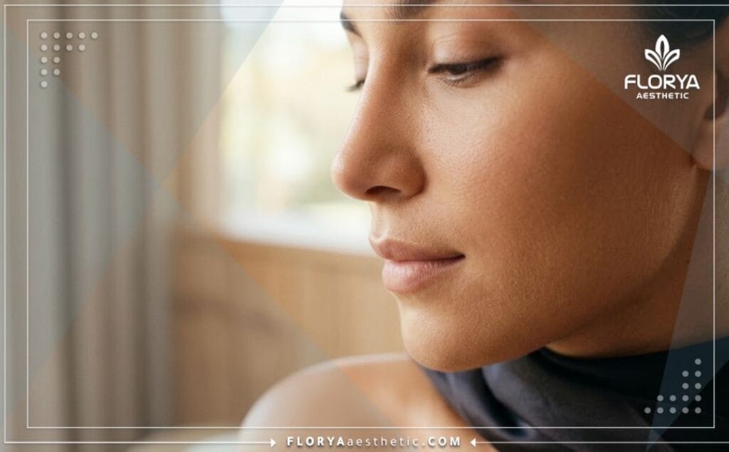 Flawless aesthetic outcome of a successful nose reshaping procedure.