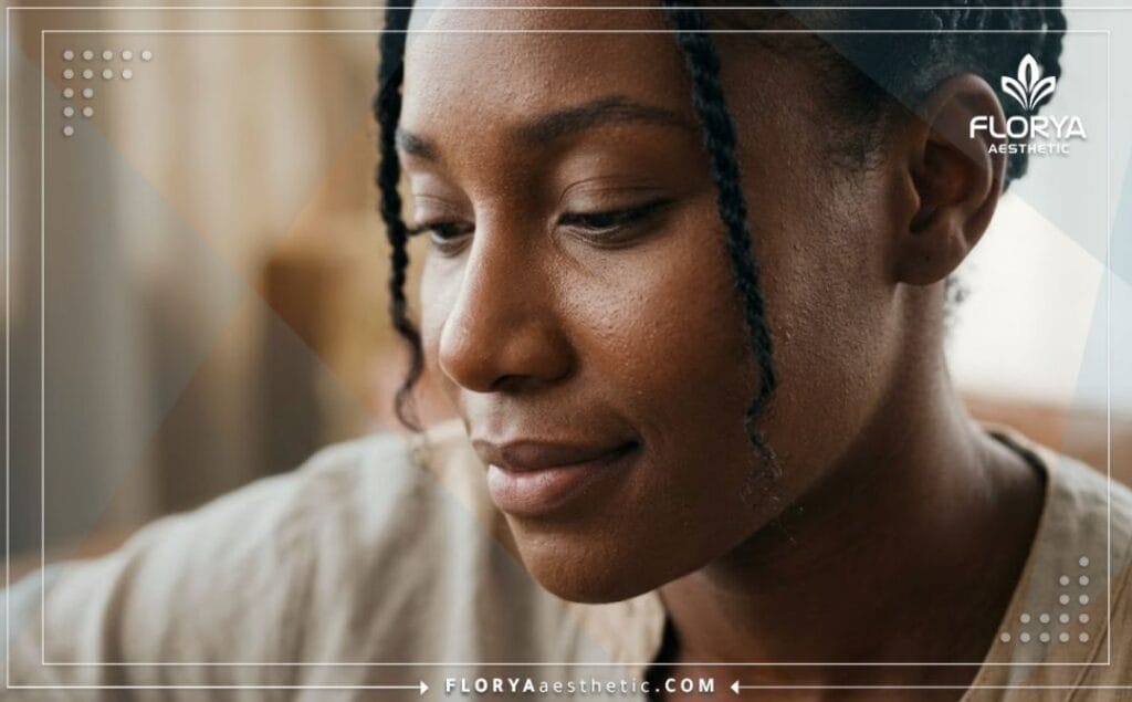 Flawless and natural aesthetic results following a successful ethnic nose procedure.