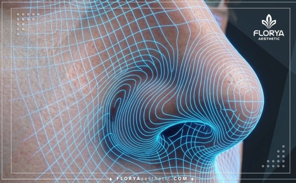مسح ثلاثي الأبعاد دقيق لمنطقة الأنف والصمام الأنفي يوضح التفاصيل التشريحية.