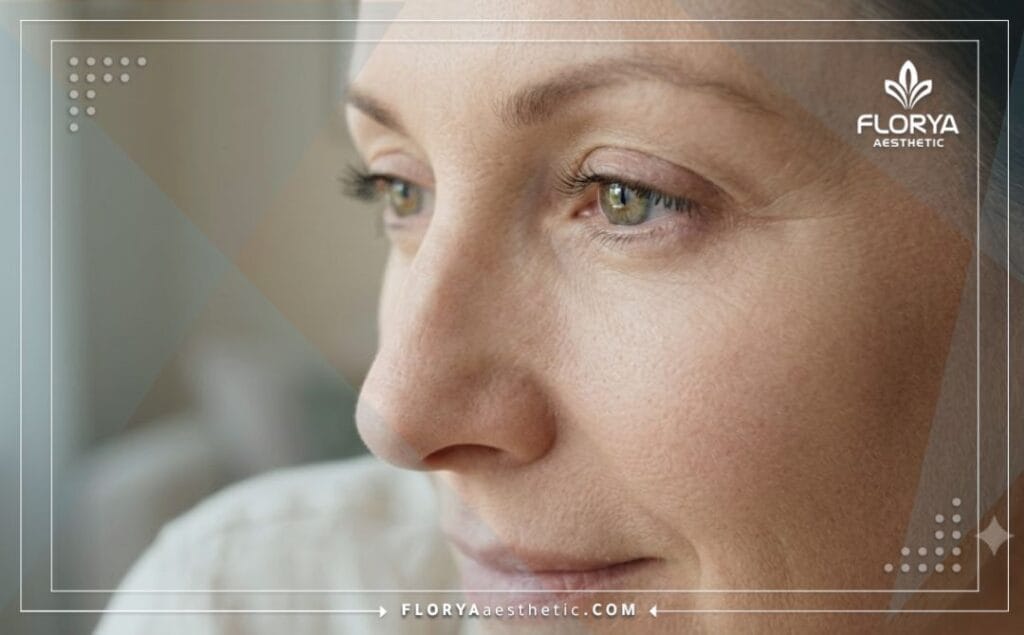 Cinematic close-up showing a flawless youthful under-eye result