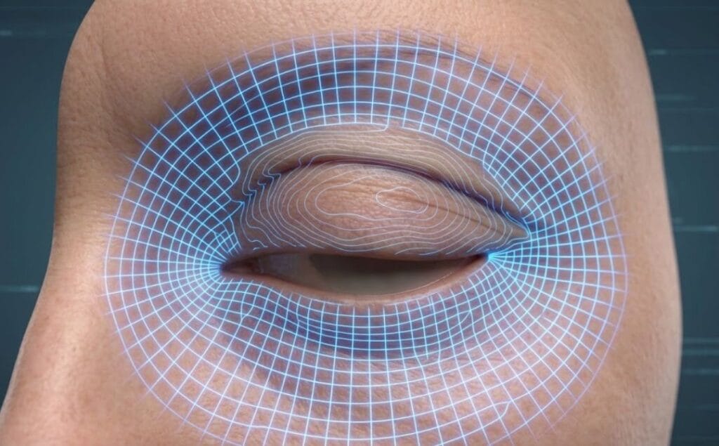 مسح رقمي ثلاثي الأبعاد لمنطقة العين والجفون يوضح دقة العلاج بالليزر